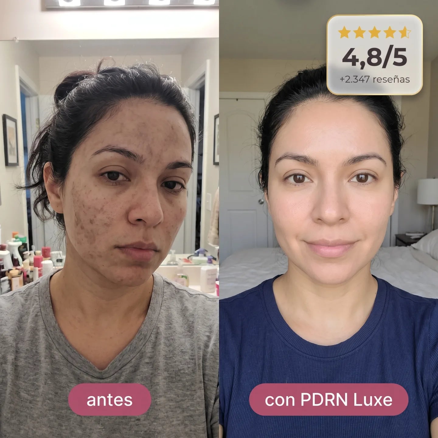 PDRN Luxe antes y después en mujer morena mexicana — piel uniforme con cobertura real, valoración 4,8/5 con +2.347 reseñas