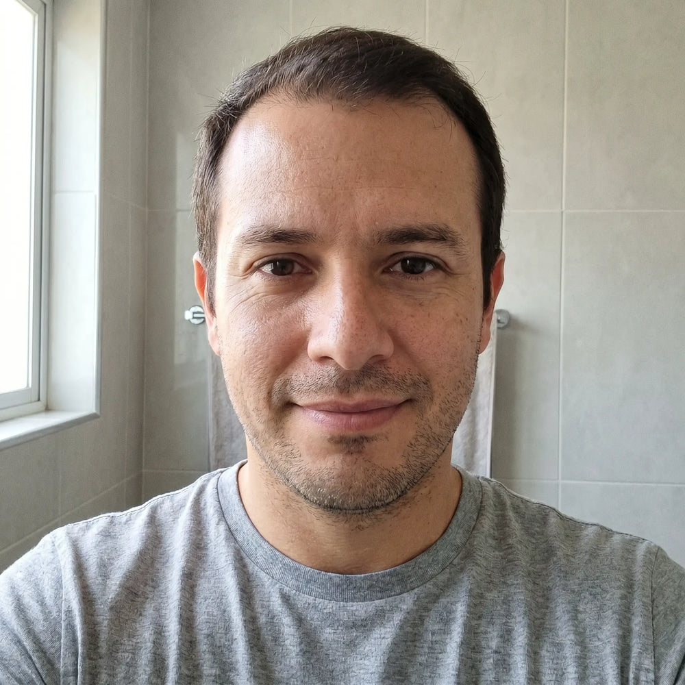 Cliente PDRN Hair Booster hombre 34 anos testimonio
