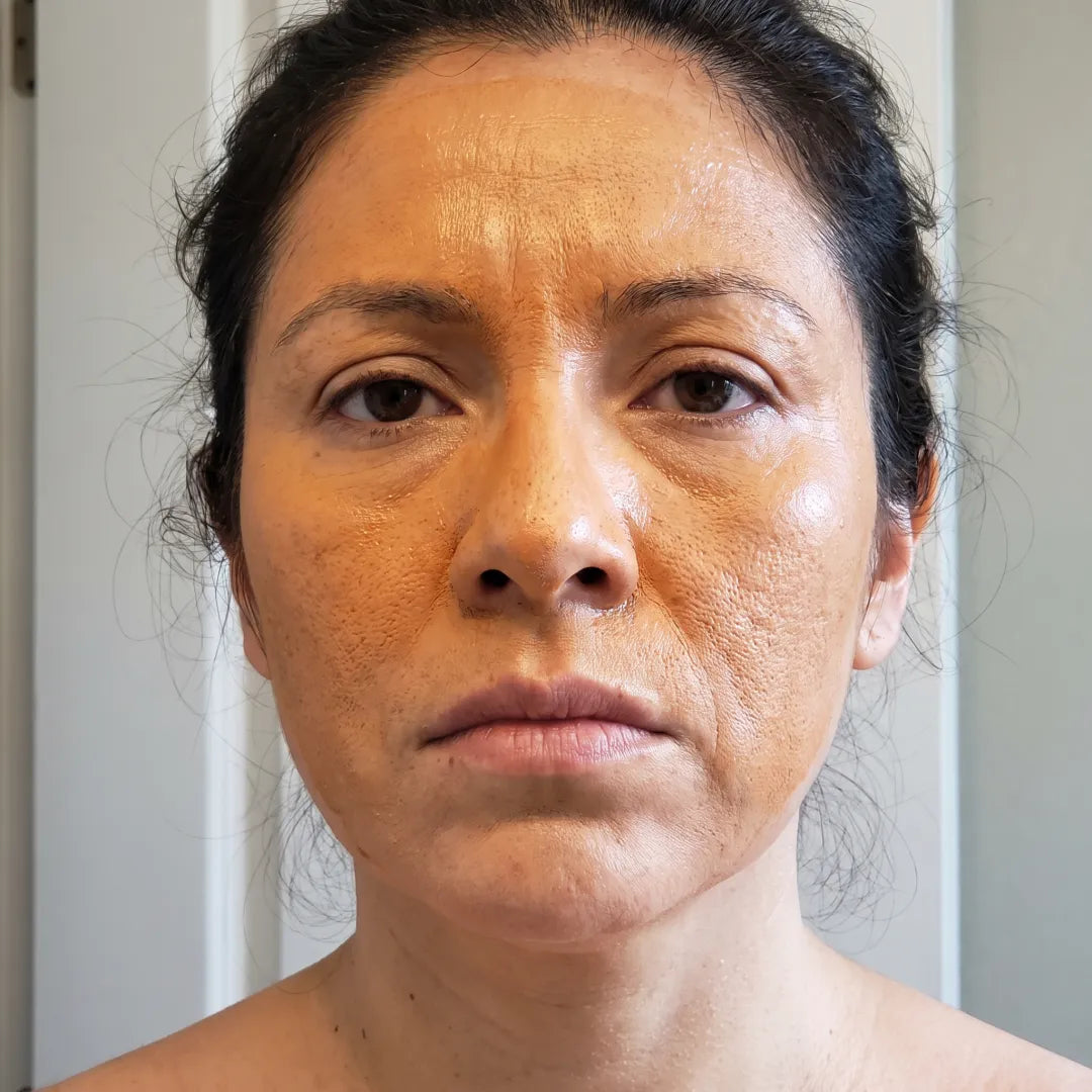 Antes: base oxidada, piel naranja a media manana