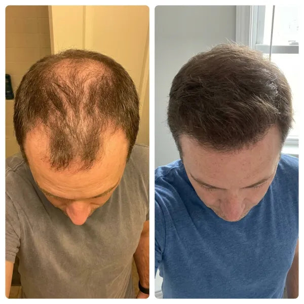 Antes y después · pelo