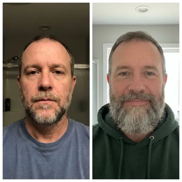 Antes y después · barba