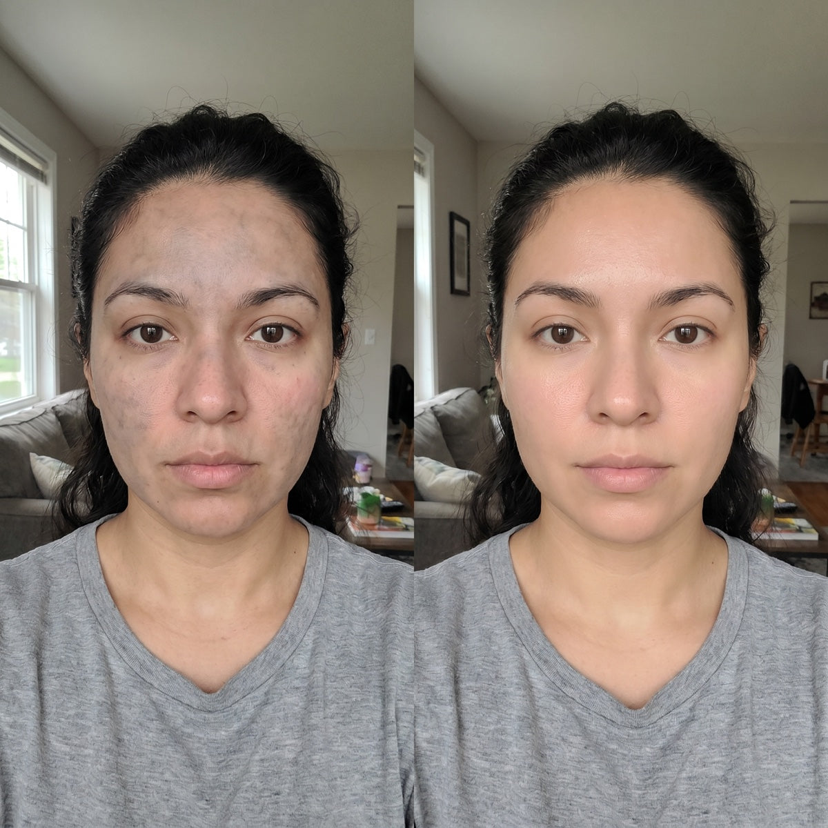 PDRN Luxe antes y despues