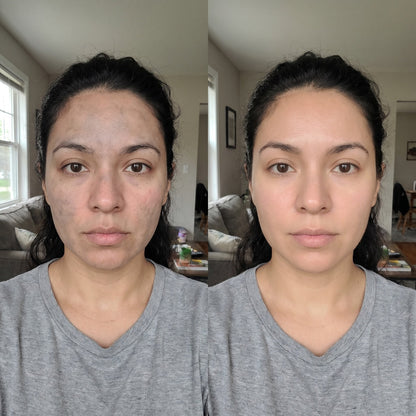 PDRN Luxe antes y despues